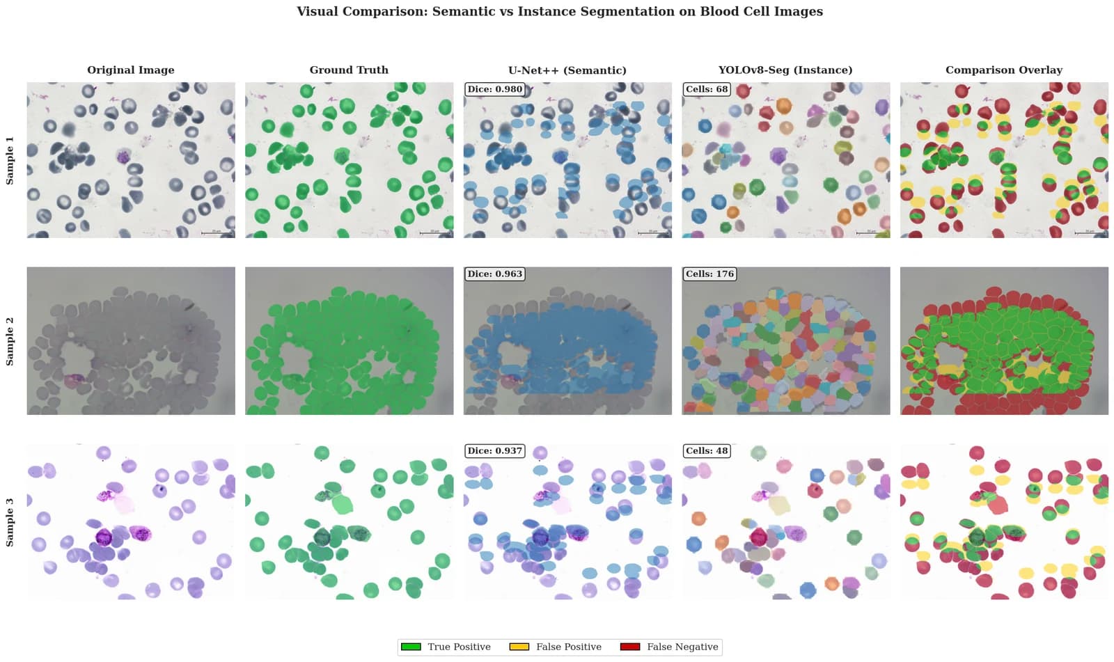 Blood Cell Segmentation Benchmark